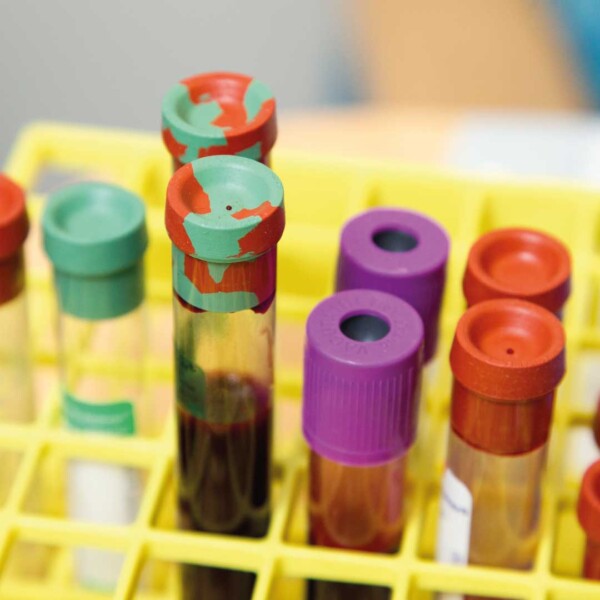 Caiado Guerreiro assessorou venda da Labdiagnóstica à Workcell